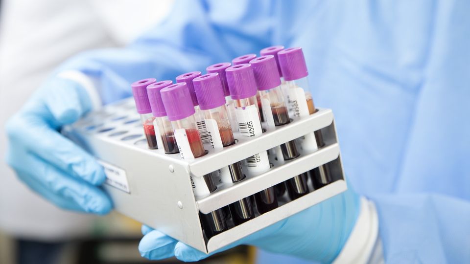 Laboratory testing